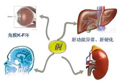 人體黄瓜视频色板數據能夠準檢測出但身體中微量元素銅超標會引起疾病發生 人體黄瓜视频色板數據能夠準檢測出但身體中微量元素銅超標會引起疾病發生
